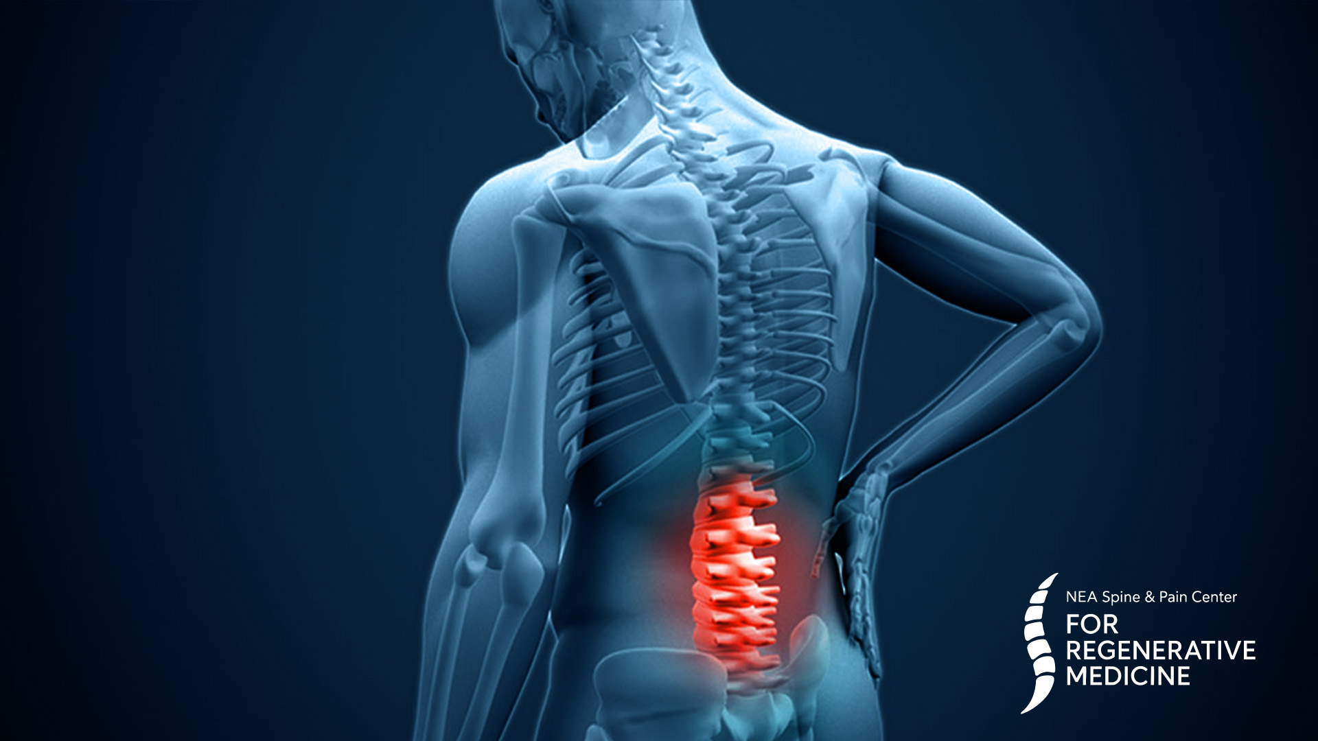 Minimally -Invasive-Lumbar-Decompression